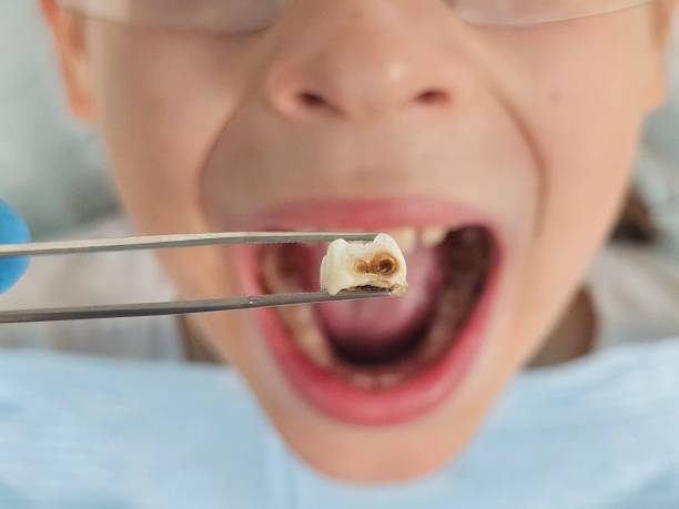 Best Same-Day Emergency Dental Services in Ponca City, OK